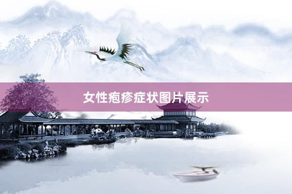 女性疱疹症状图片展示